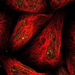 MYH Antibody, Novus Biologicals 25 &mu;L | Buy Online | Novus Biologicals | Fisher Scientific